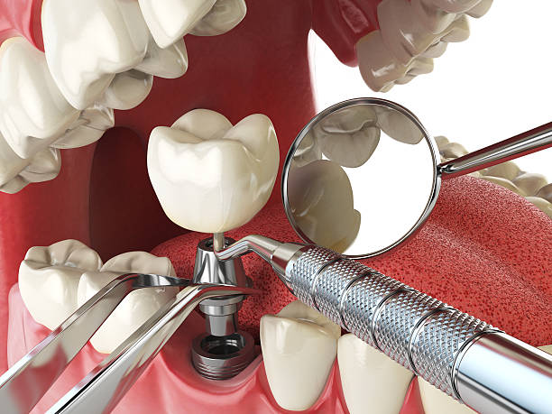 Best Weekend Emergency Dentist in Decatur, IN